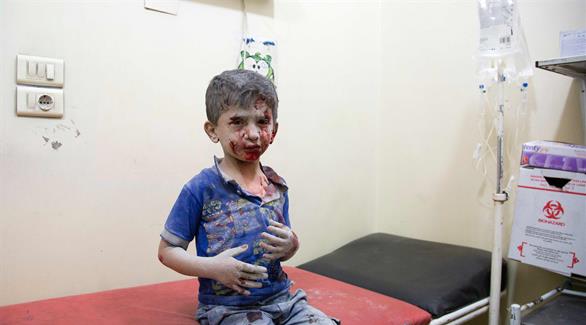 طفل مصاب إثر الغارات على حلب (أ ف ب)