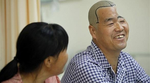 المزارع الصيني بعد العملية الجراحية