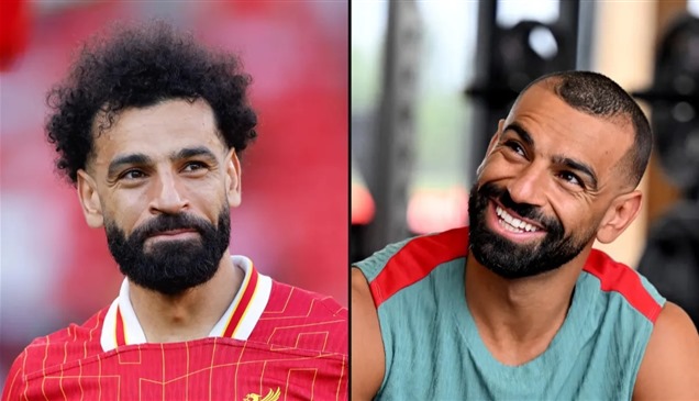 بالصور.. 10 نجوم عالميين خضعوا لعمليات تجميل