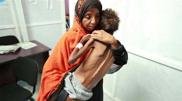 يمنية تحمل طفلها المنهك بسبب الجوع (أرشيف)